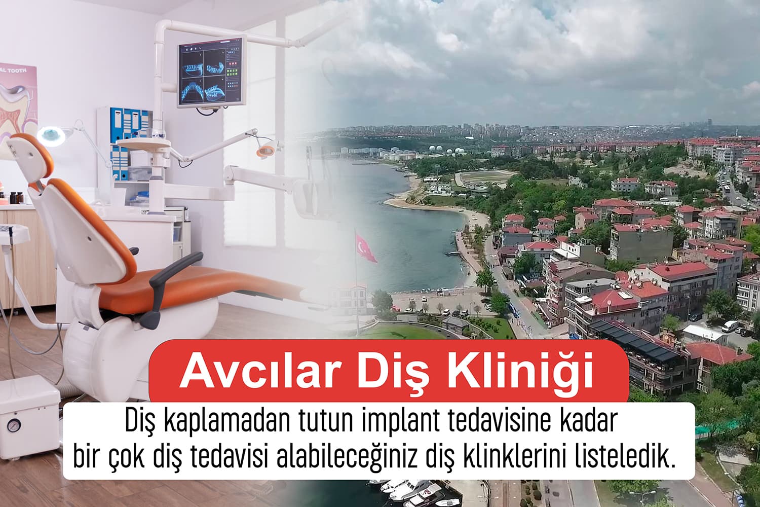 Avcılar Zirkonyum Diş Kaplama Fiyatları